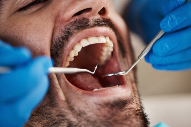 Best Emergency Dentist for Knocked-Out Tooth in Texarkana, TX